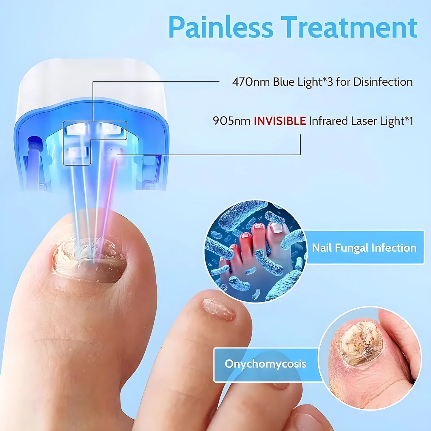 Professional Nail Fungus Treatment Kit for Effective Removal of Fungal Infections